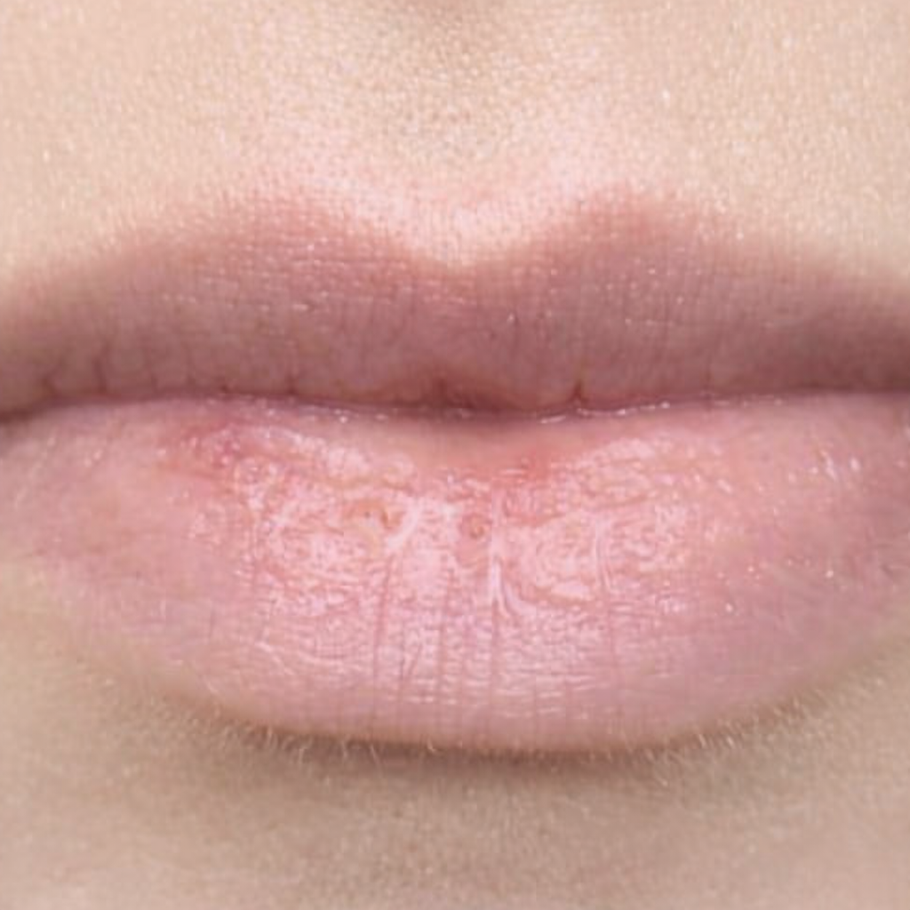 Glownetz. Liplift Roller - Mit wenigen Anwedungen zu volleren Lippen