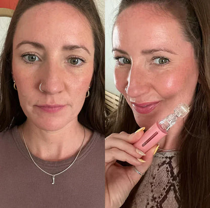 Glownetz. Liplift Roller - Mit wenigen Anwedungen zu volleren Lippen
